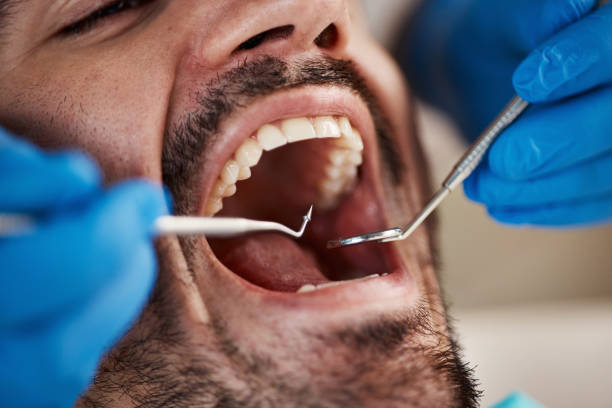 Best Emergency Treatment for Toothache in Auburn, KY