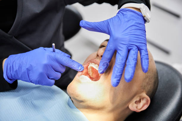 Best Emergency Tooth Extraction in Auburn, KY